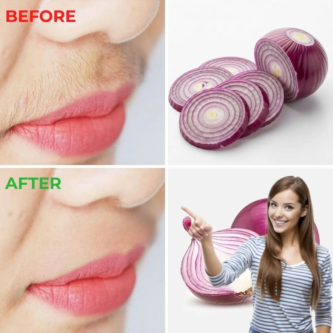 Shocking Secret Revealed: Erase Facial Hair Naturally with THIS Kitchen Staple!