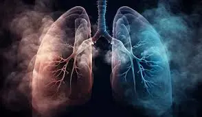 Non-Smoker Diagnosed with Lung Cancer Shares His Only 'Silent' Symptom