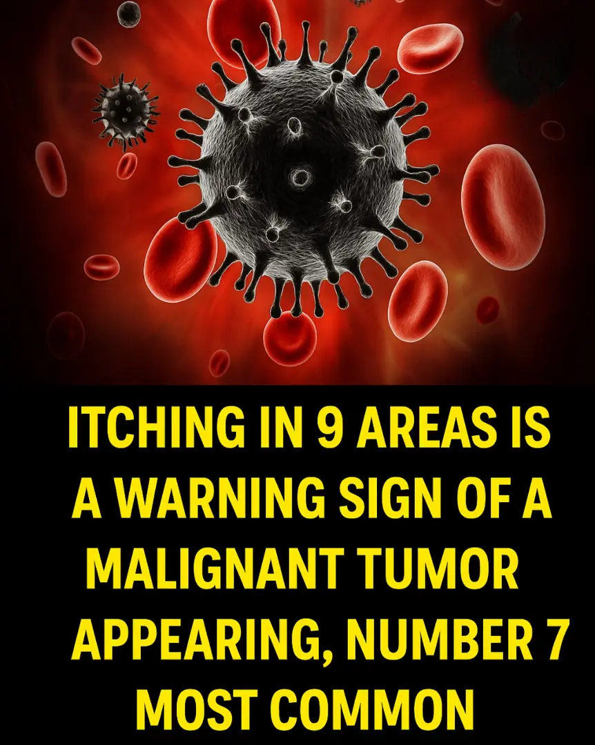 Itching in 9 Areas: A Warning Sign of Malignant Tumors, Number 7 Is the Most Common