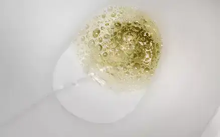 Foamy Urine: Why You Have Bubbles in Your Pee and When to Worry
