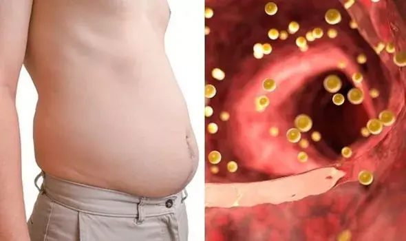 Bloated Stomach: 8 Common Reasons and How to Treat Them (Evidence-Based)