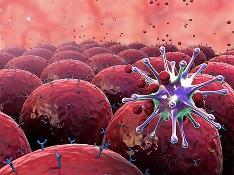 Doctor’s Warning: Early-Stage Lung Cancer Doesn’t Always Include a Cough – Watch for These 4 Unusual Signs