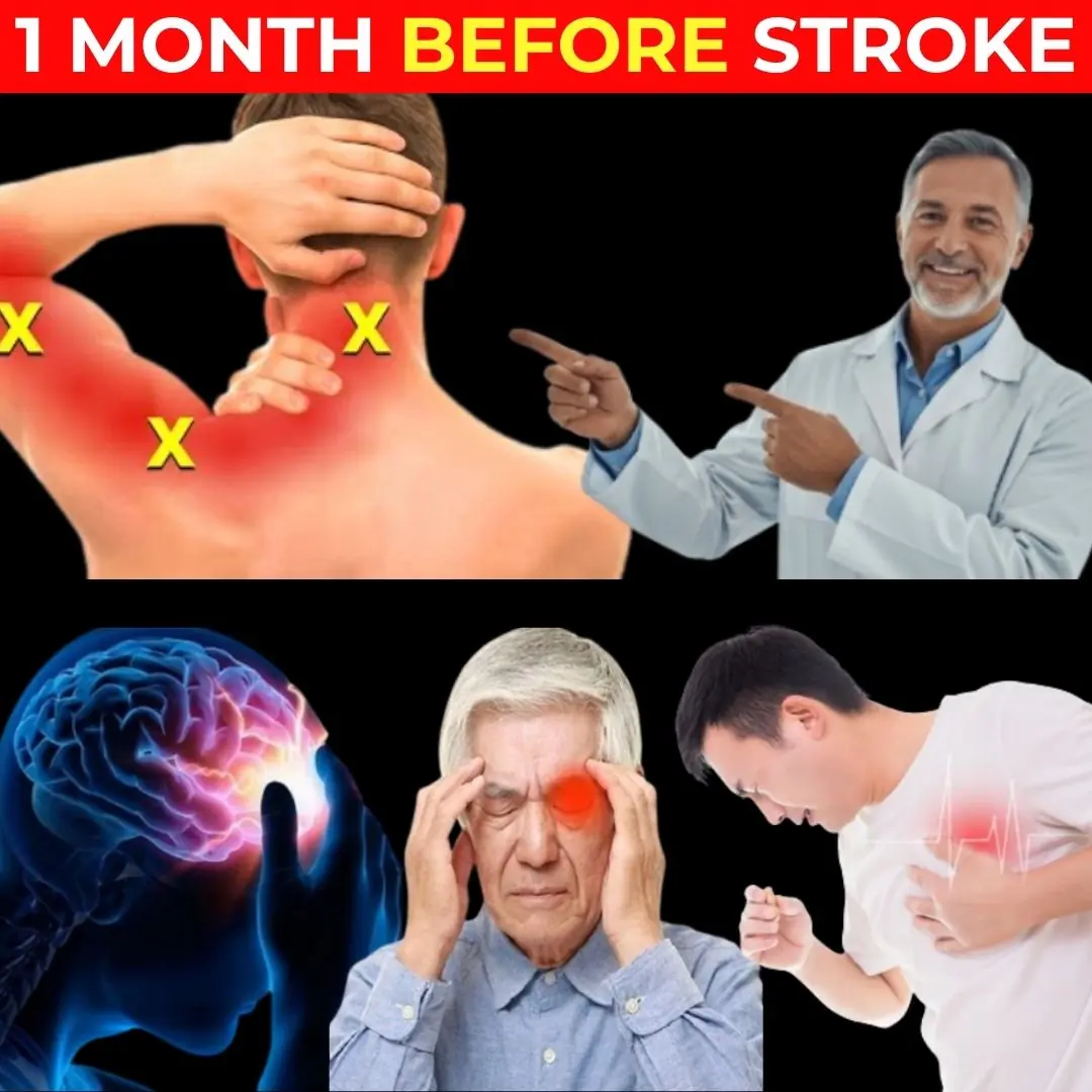 7 Early Warning Signs of a Stroke – Recognize Stroke Symptoms FAST: THIS Could Save Your Life