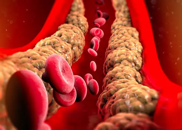 Scientists Discover an "Off Switch" for Cholesterol—Could Save Millions of Lives