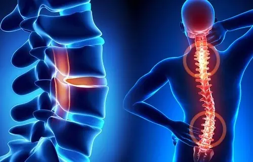Three Common Beverages That Secretly Drain Calcium from Your Bones: Drinking Too Much Can Lead to Brittle, Fragile Bones