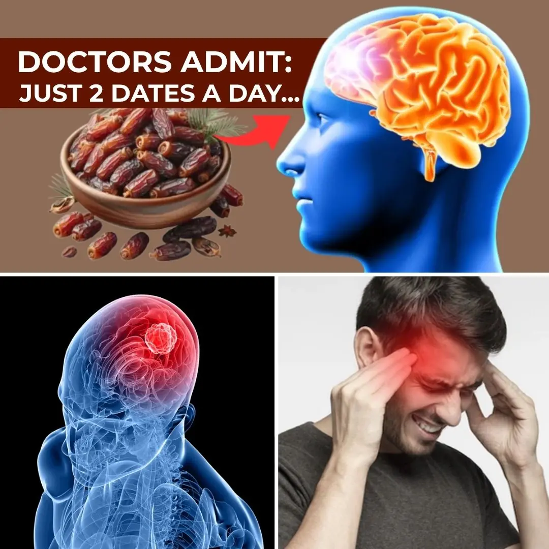 Nature’s Candy Unleashed: The Jaw-Dropping Health Hacks of Dates You NEED to Know!