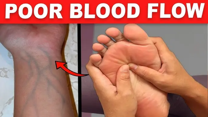 16 Warning Signs Your Blood Circulation is Poor and How to Improve It (Evidence-Based)