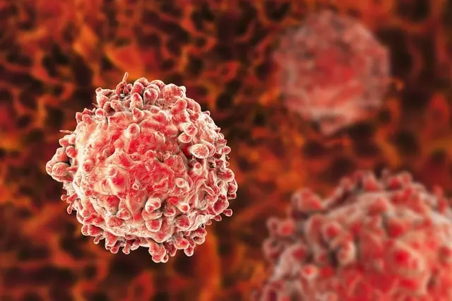 People with Cancer Often Share 8 Morning Signs—Especially Clear After Age 40