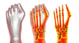 Ditch the Knife: Effective Non-Surgical Treatments for Bunion Pain Relief
