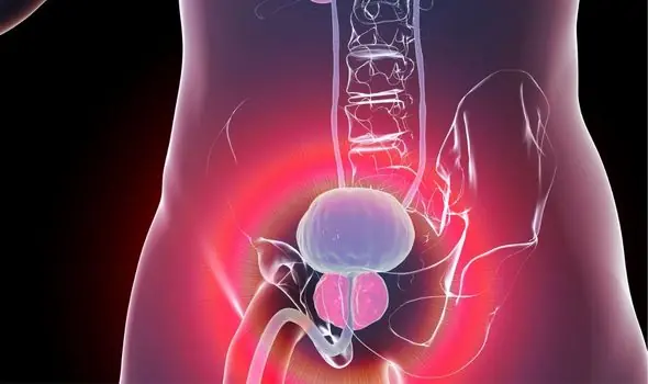Prostate Cancer: Warning Signs and Symptoms You Shouldn't Ignore