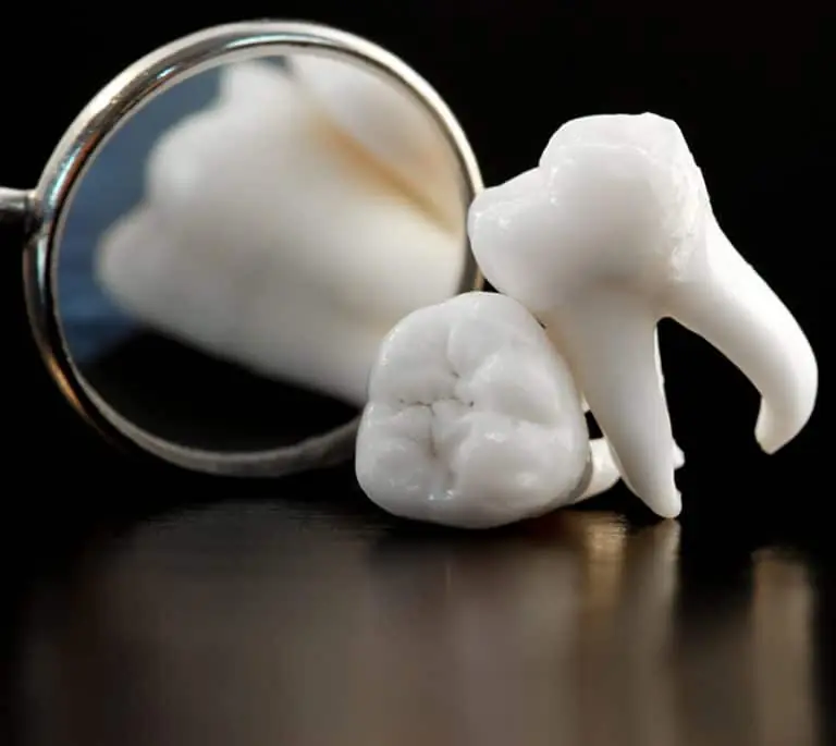 Medical Gold: Why Your Wisdom Teeth Might Hold the Key to Future Cures