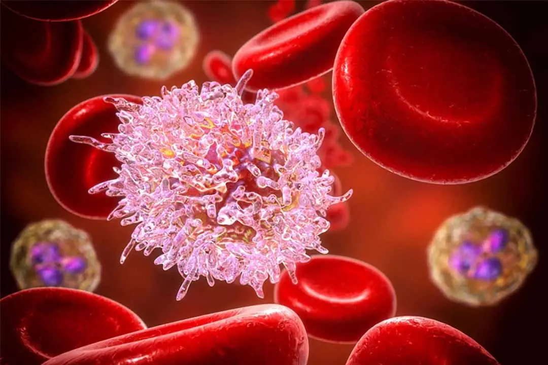 The Leading Cause of Liver Cancer Discovered – 10 Times Deadlier Than Alcohol and Tobacco: The Culprit is 'It