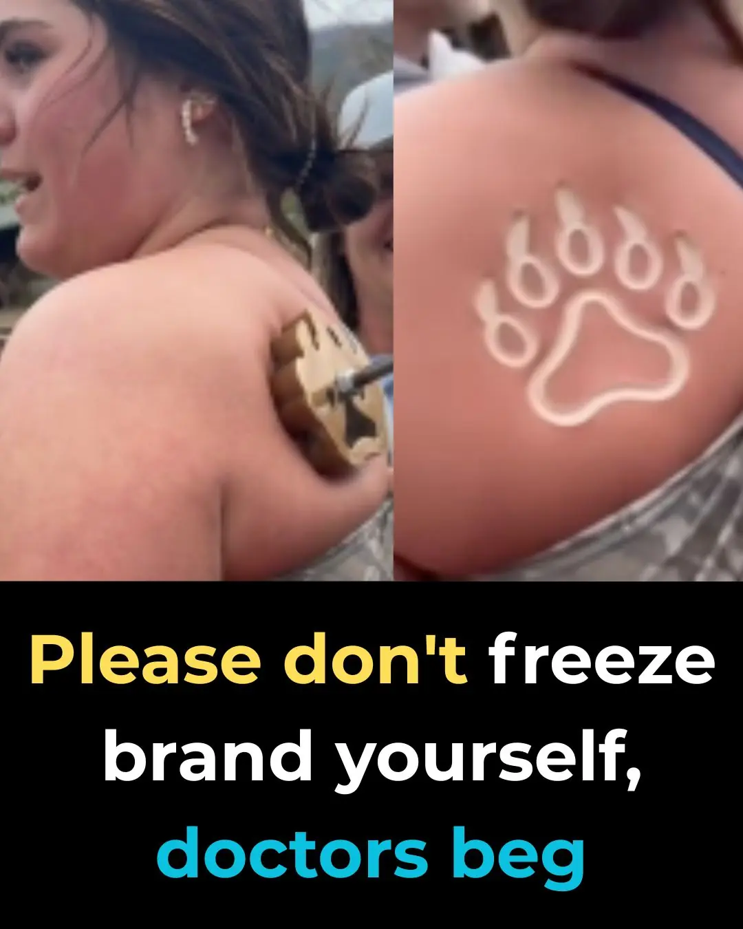 The Dangerous New Trend That Has Doctors Saying “Please, Don’t Do This”