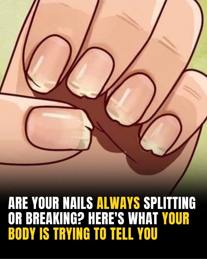 You Should Never Ignore These 9 Things Your Fingernails Reveal About Your Health