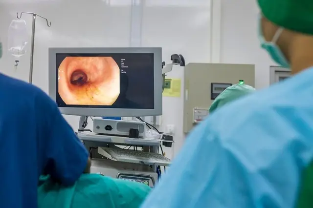 More and More Young People Are Suffering from Colon Cancer — Doctors Warn: Eat Less of These 3 Things!