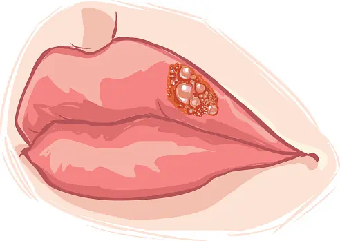 5 Hidden Nutritional Deficiencies You Likely Have (and How to Fix Them)