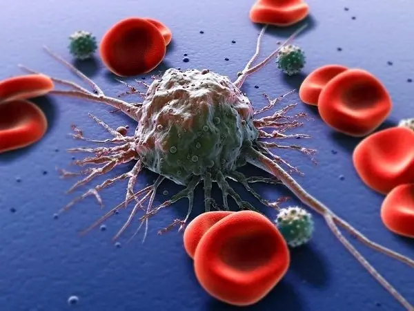 Is Cancer Hereditary? Helpful Tips to Prevent the Growth of Cancer Cells
