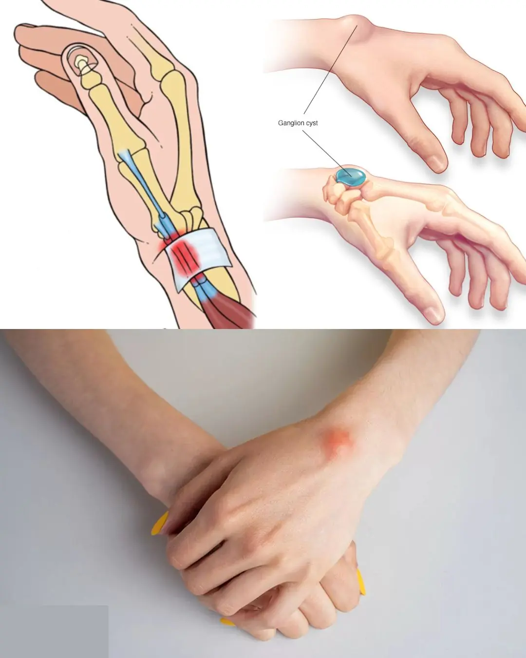 Healing Power And Important Safety Tips Of Castor Leaves