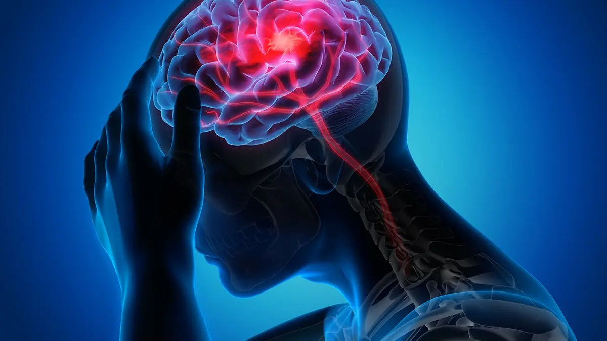 Stroke Often Targets People Who Exercise This Way: Change Your Habits Now If This Is You