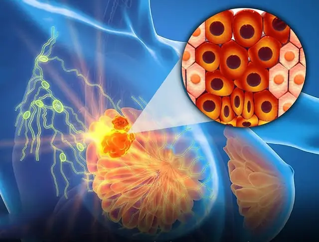 Eliminating Parabens and Phthalates from Daily Use Reverses Cancer-Linked Changes in Healthy Breast Tissue, Study Finds