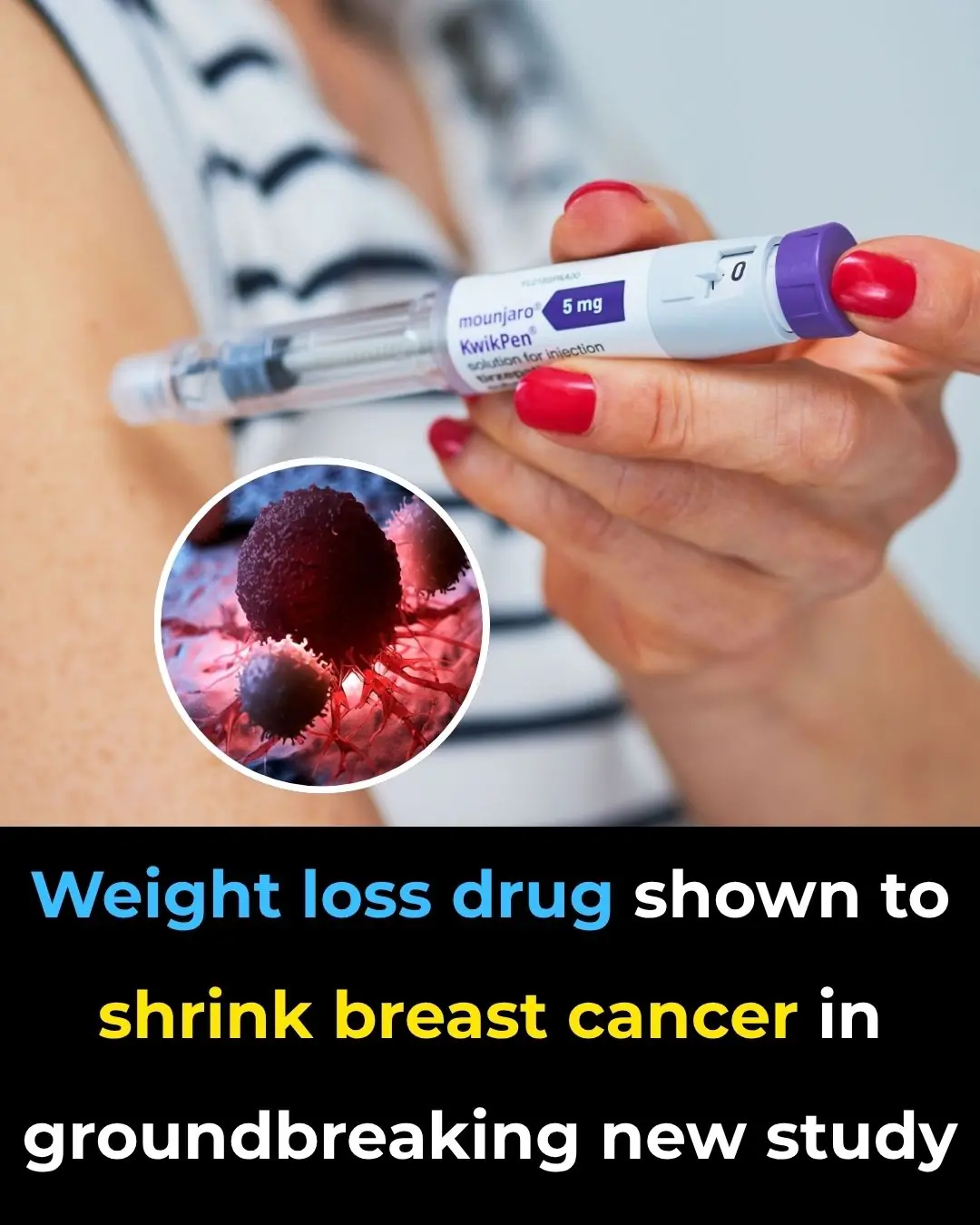 Weight loss drug shown to shrink breast cancer in groundbreaking new study
