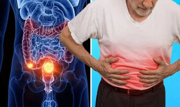 'Healthy' 38-Year-Old Shares His Only Bowel Cancer Symptom — And It Wasn't Blood in the Loo