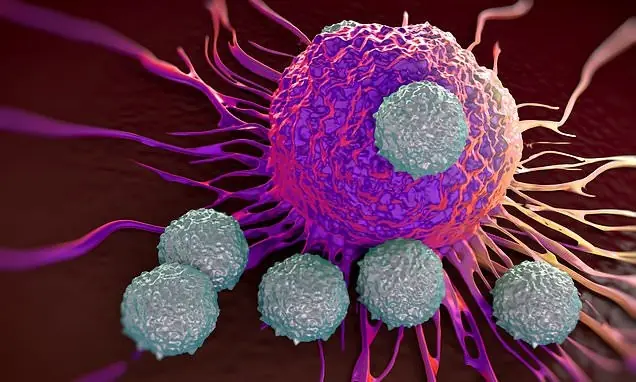 Discover 20 signs of cancer that most women ignore