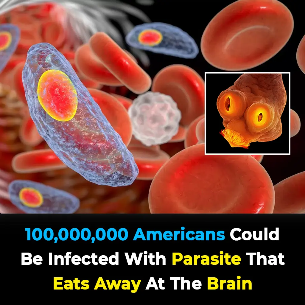 100 Million Americans at Risk from Brain-Eating Parasite, Experts Warn