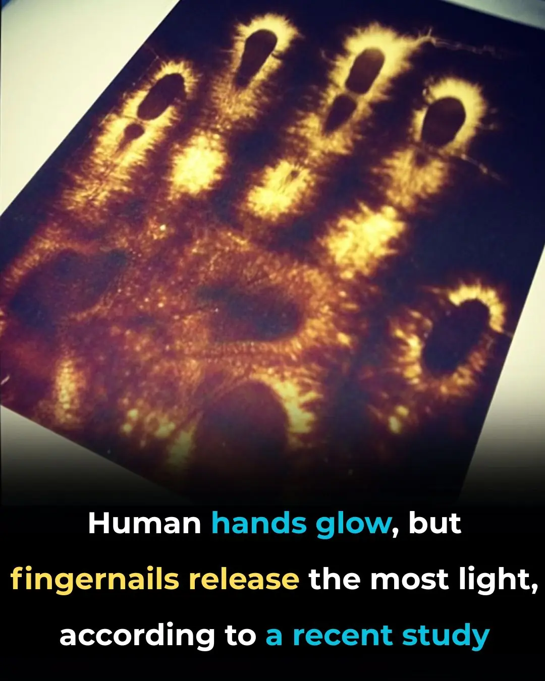 The Hidden Light In Your Hands That Shouldn’t Be Dimmed