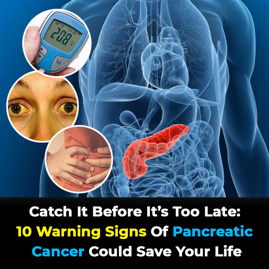 10 Warning Signs of Pancreatic Cancer Could Save Your Life