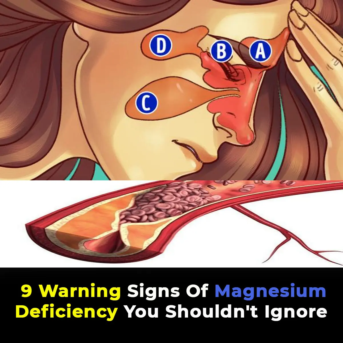 Why Are 80% of People Magnesium Deficient? The Answer Will Surprise You