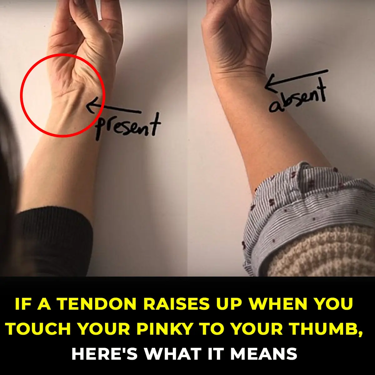 A Strange Tendon Reaction You Never Knew About – Just by Touching Your Pinky to Your Thumb