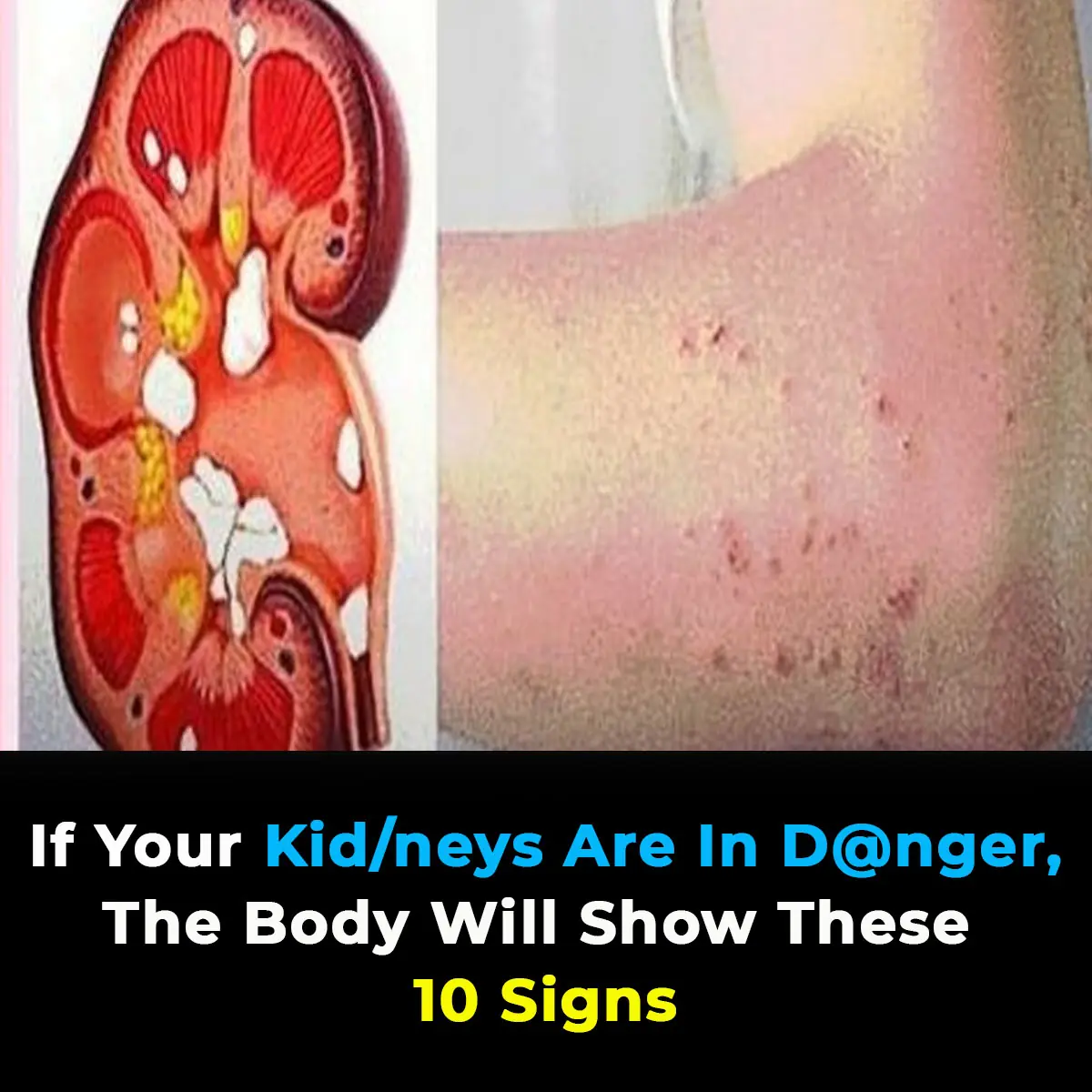 10 Signs You May Have Kidney Disease