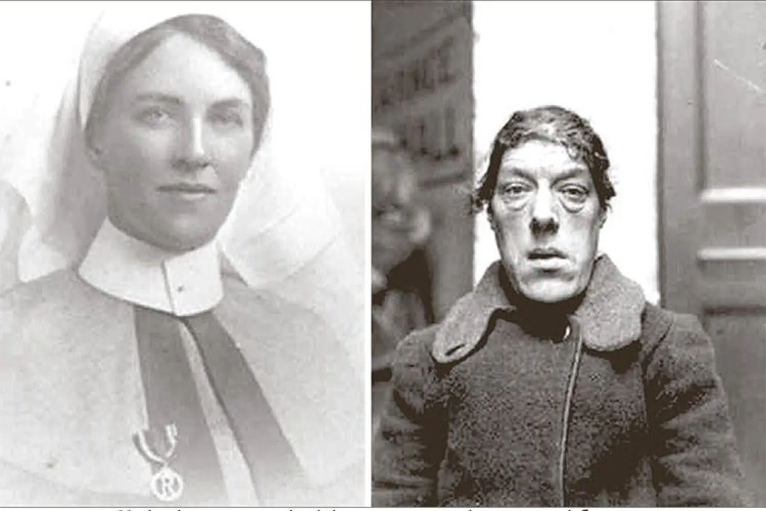 Mary Ann Bevan: The Tragic Story of the ‘World’s Ugliest Woman’