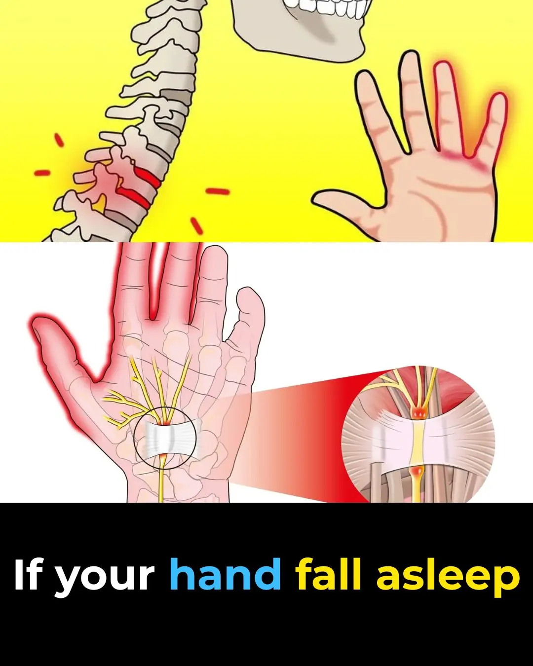 Tingling Sensation In Your Body: Why Does It Happen