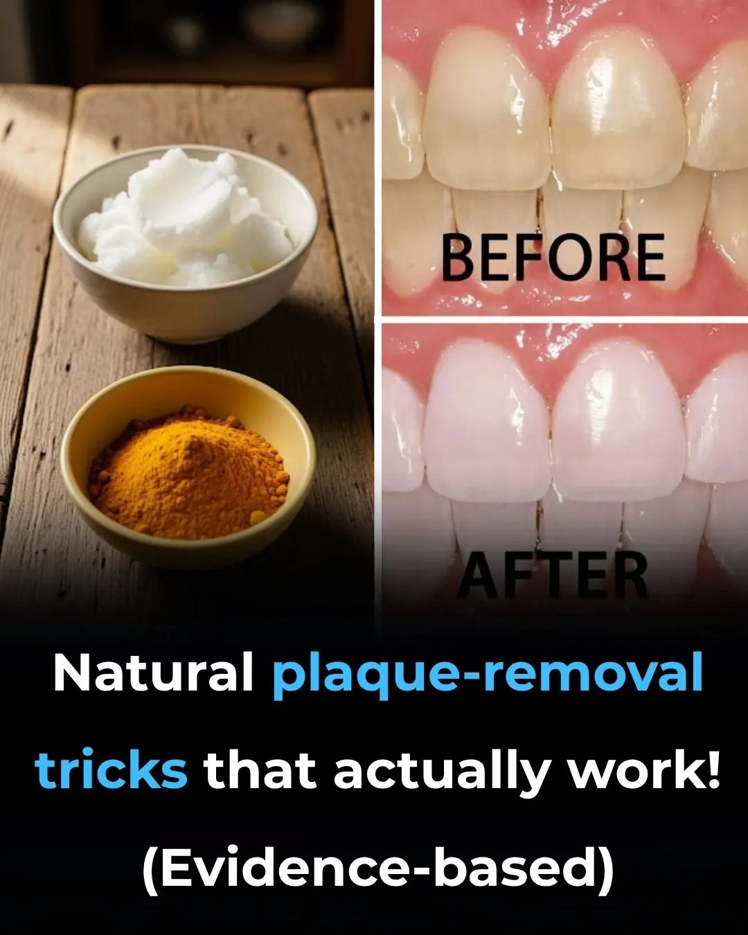 How to Remove Dental Plaque Naturally (Evidence Based)