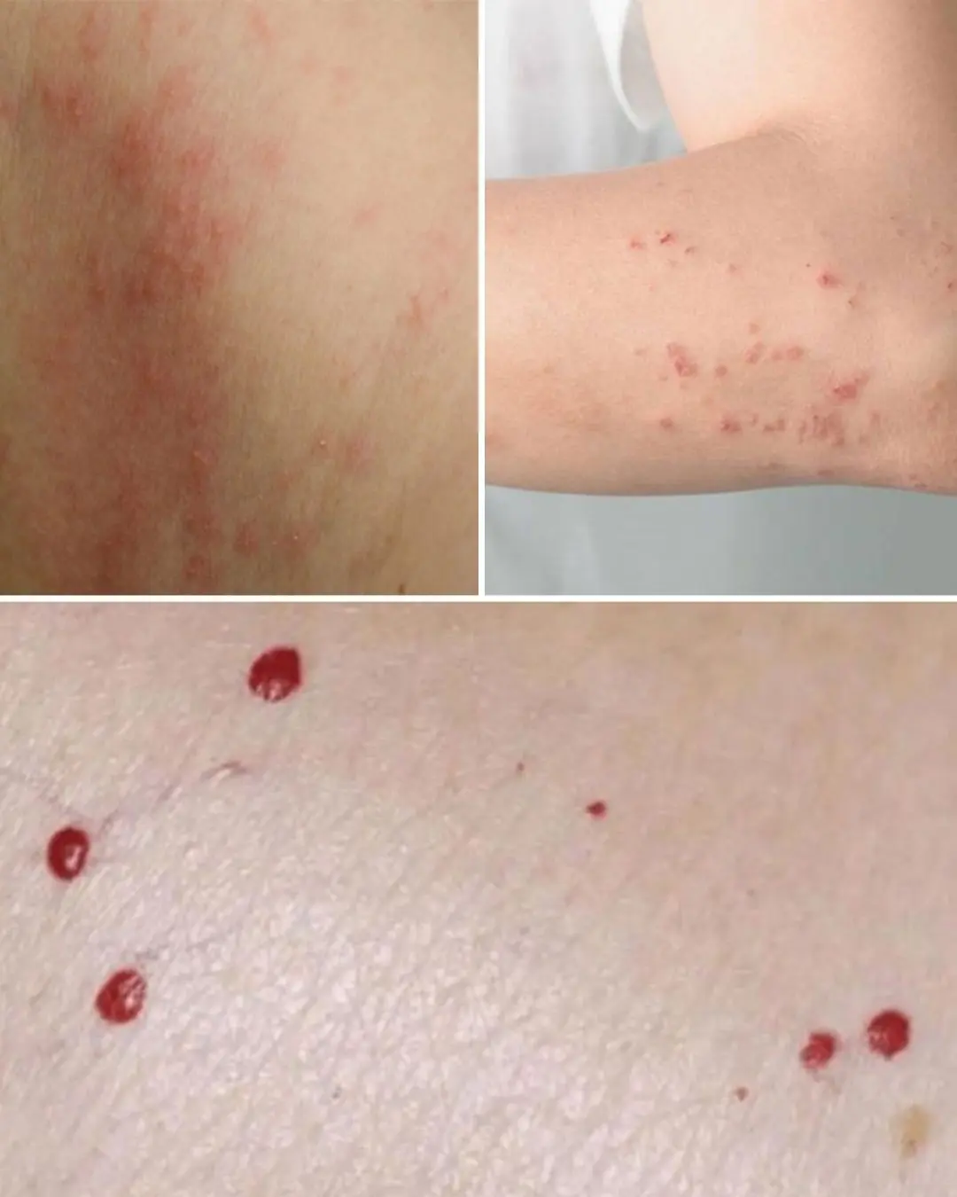 Red Spots on Skin: 13 Common Causes