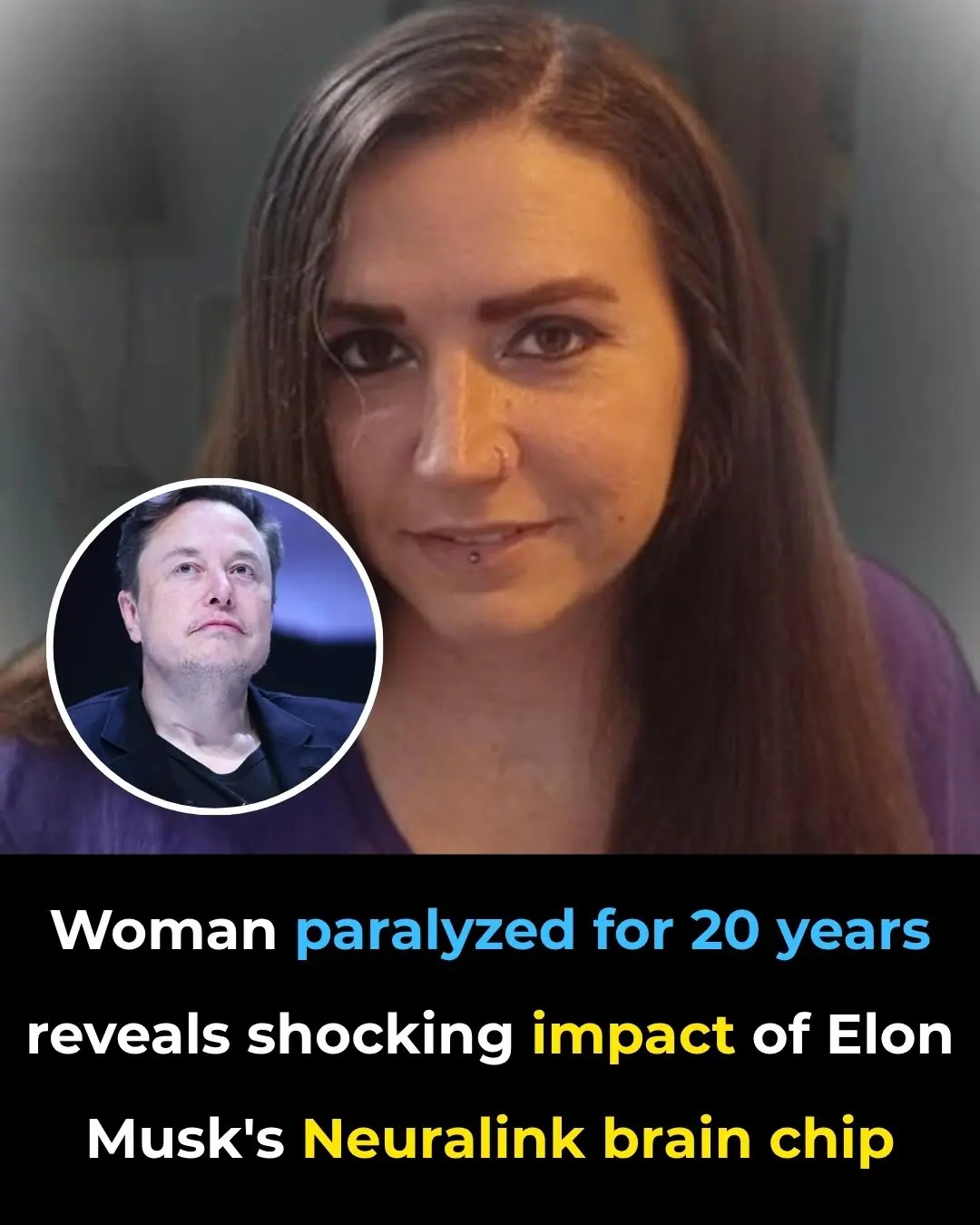Woman paralyzed for 20 years reveals shocking impact of Elon Musk's Neuralink brain chip