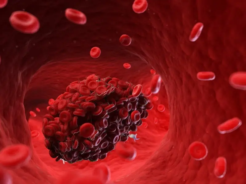 Cardiologists Say This Common Habit Is a Blood Clot Risk