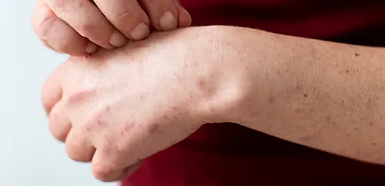 If You Have These Tiny Red Dots On Your Arm, Do Not Ignore The Warning Signs