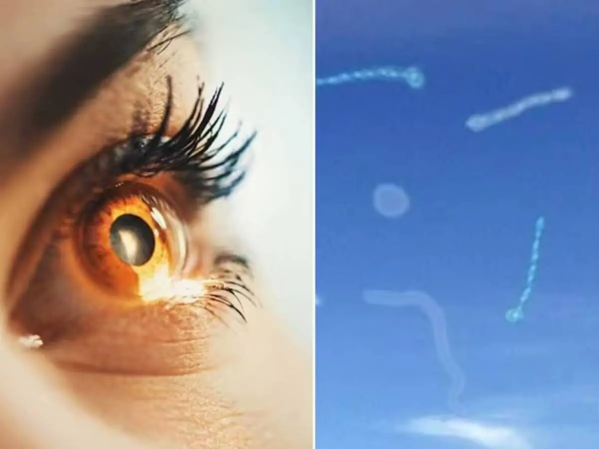 An Eye Specialist Explains What To Do If You Begin To See “Floaters”