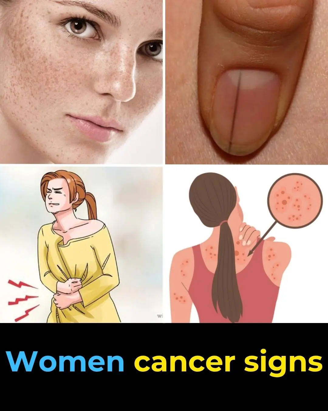 10 Cancer Warning Signs Women Often Overlook