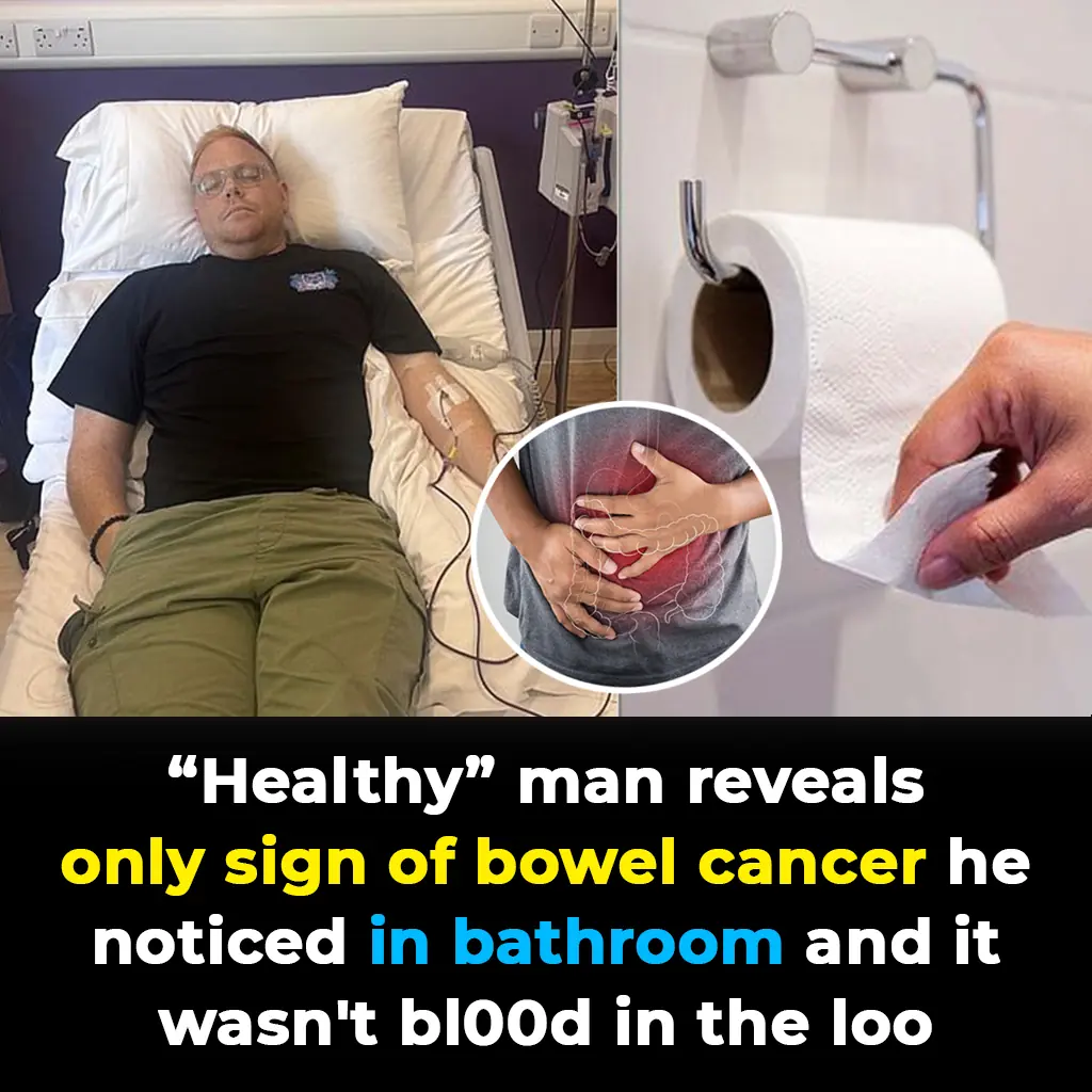 'Healthy' man reveals only sign of bowel cancer he noticed in bathroom - and it wasn't bl00d in the loo