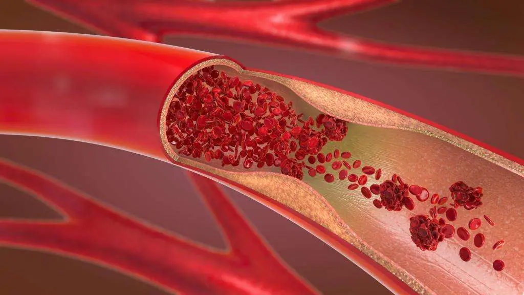 How to Improve Blood Circulation Naturally (Research Based)