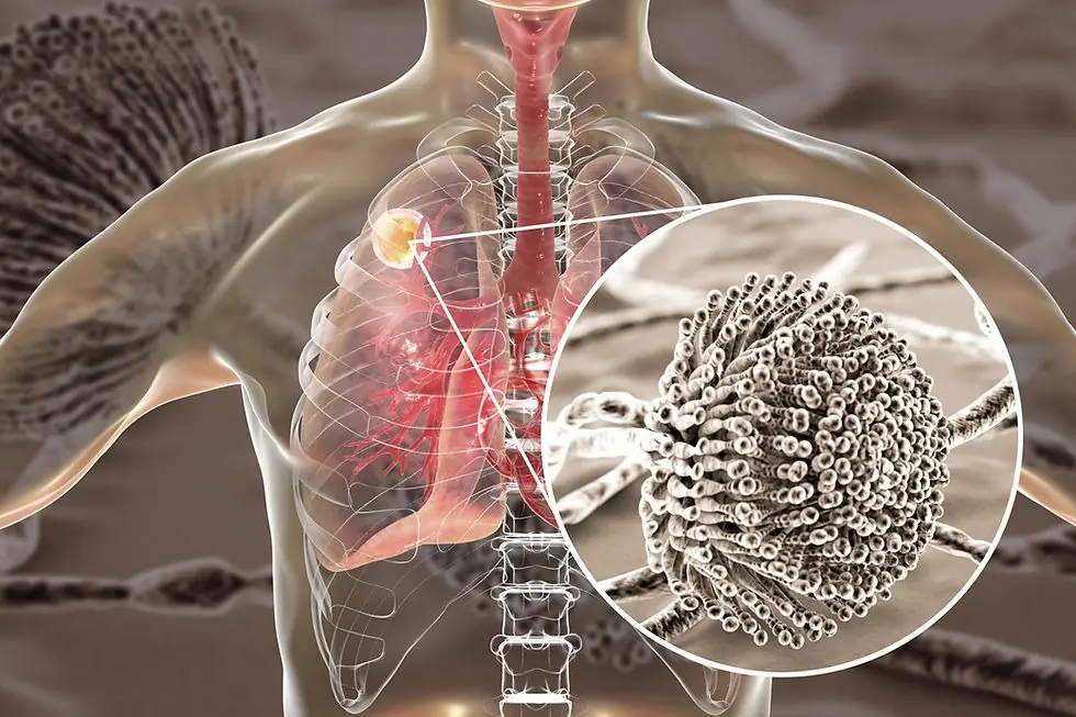 10 Early Warning Signs You’re Being Exposed to Mold Toxicity (Millions Are Exposed Every Day)