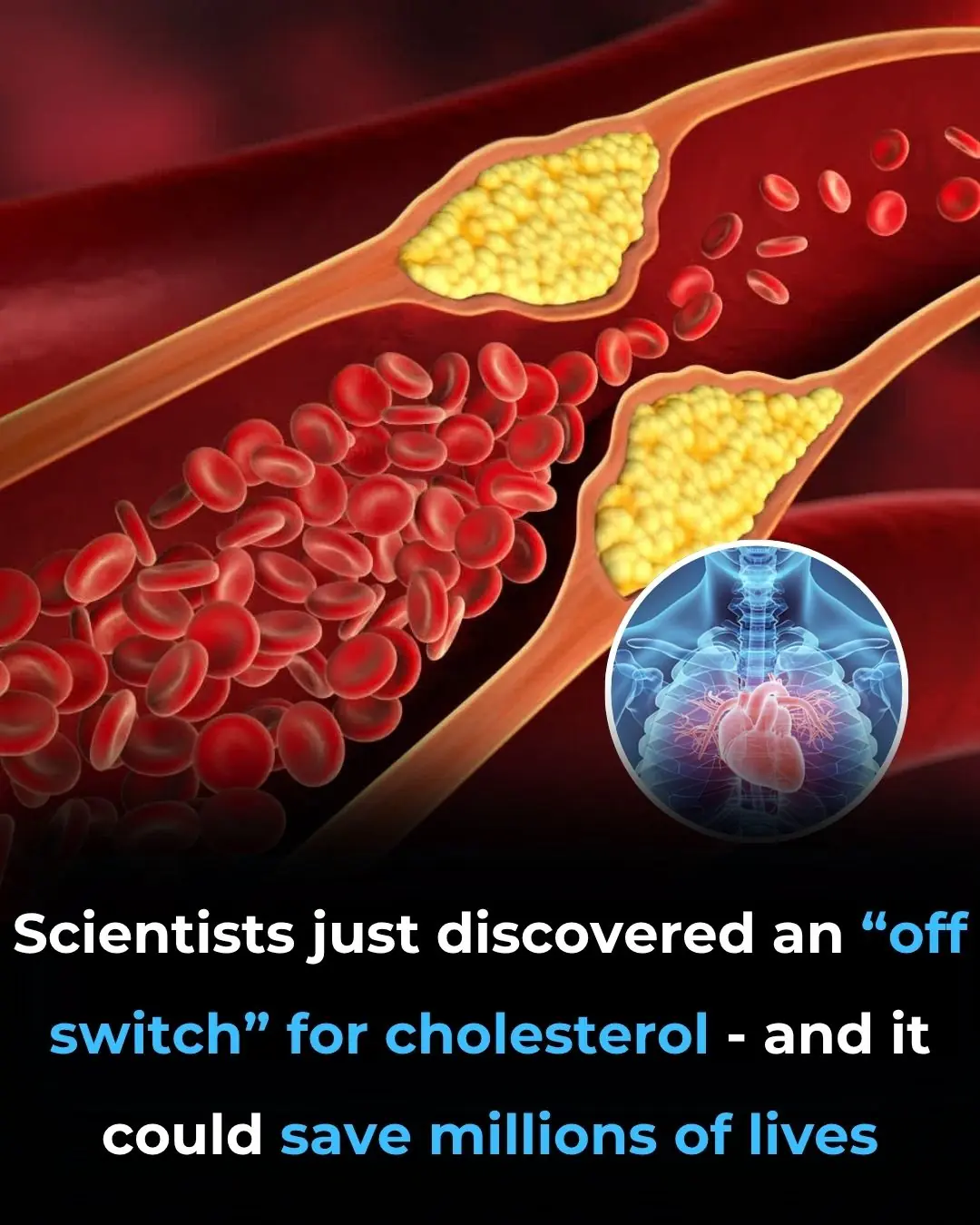 Scientists Just Discovered an “Off Switch” for Cholesterol And It Could Save Millions of Lives