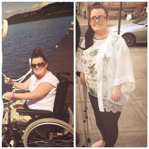Woman Endures Years of Swollen Foot Before Doctor Reveals Shocking Cause
