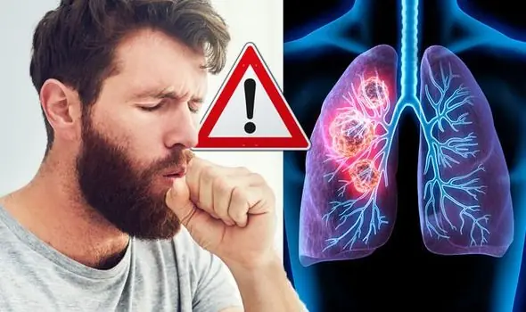 7 Warning Signs of Lung Cancer You Shouldn’t Ignore