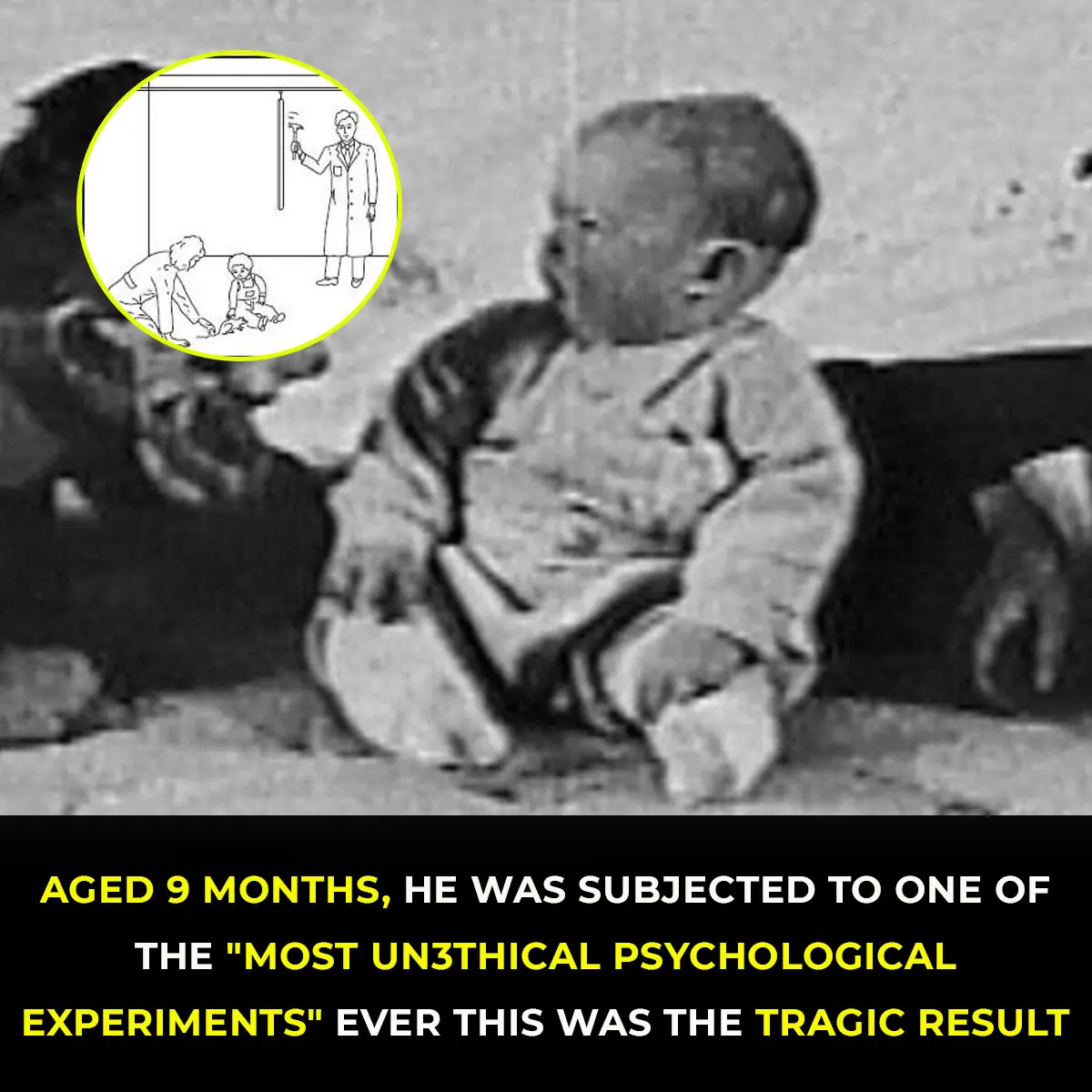The Heartbreaking Fate Of ‘Little Albert’: Child Subject Of Historic Study Died At Just Six