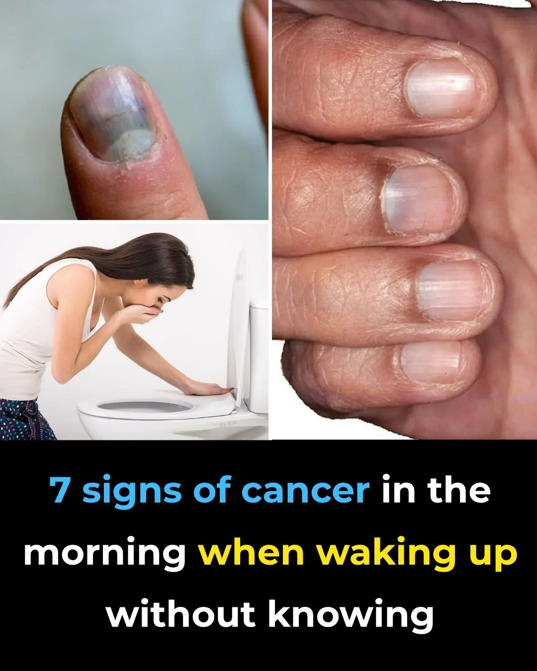 7 signs of cancer in the morning when waking up without knowing